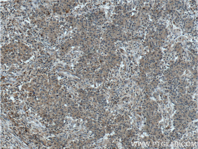 TNFSF13 Antibody in Immunohistochemistry (Paraffin) (IHC (P))