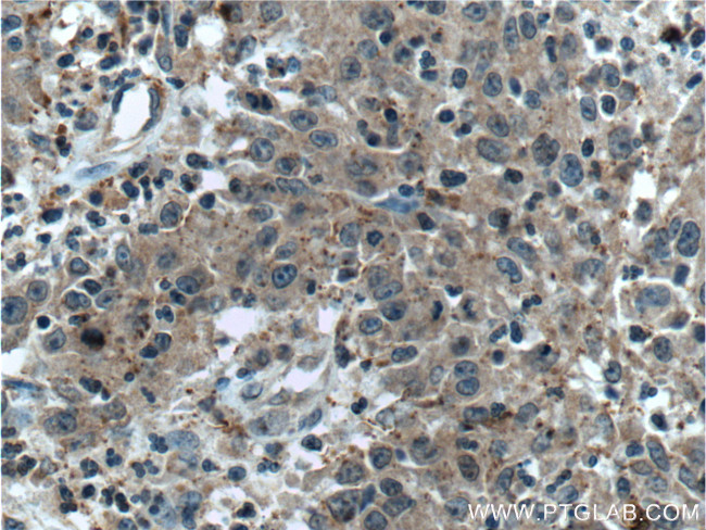 TNFSF13 Antibody in Immunohistochemistry (Paraffin) (IHC (P))