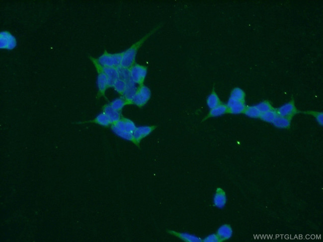 TPMT Antibody in Immunocytochemistry (ICC/IF)