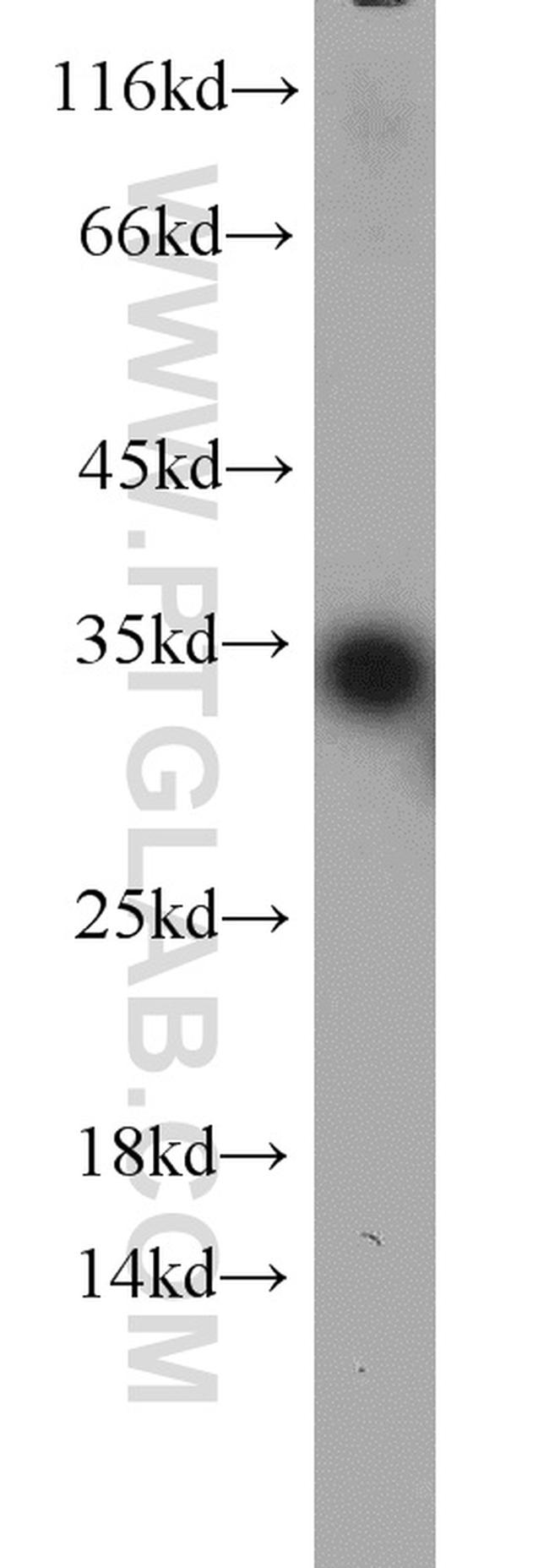 TPMT Antibody in Western Blot (WB)