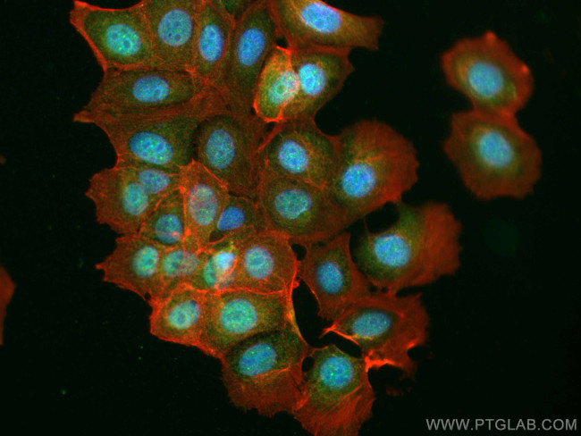 ETV4 Antibody in Immunocytochemistry (ICC/IF)