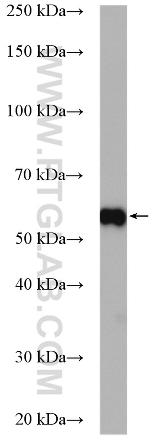 ETV4 Antibody in Western Blot (WB)