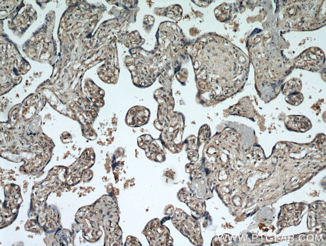 RERG Antibody in Immunohistochemistry (Paraffin) (IHC (P))