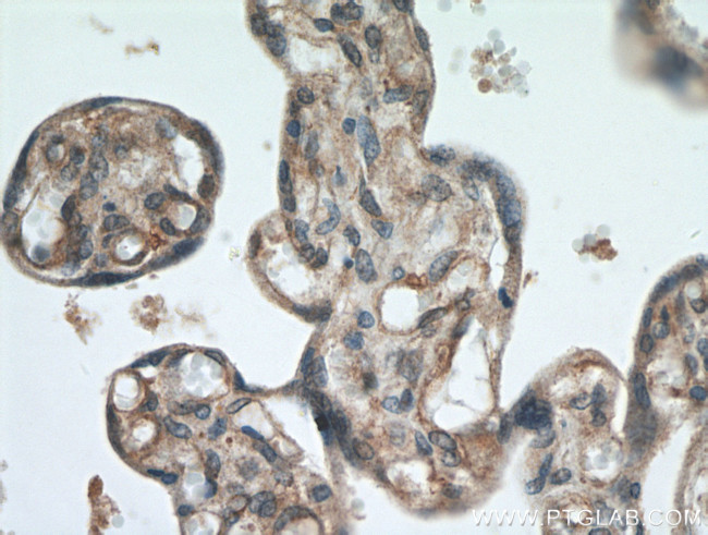 RERG Antibody in Immunohistochemistry (Paraffin) (IHC (P))