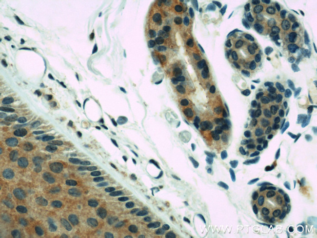 RERG Antibody in Immunohistochemistry (Paraffin) (IHC (P))