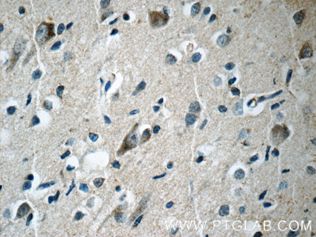 RERG Antibody in Immunohistochemistry (Paraffin) (IHC (P))