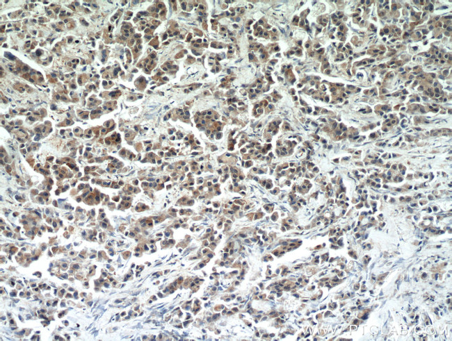 RERG Antibody in Immunohistochemistry (Paraffin) (IHC (P))