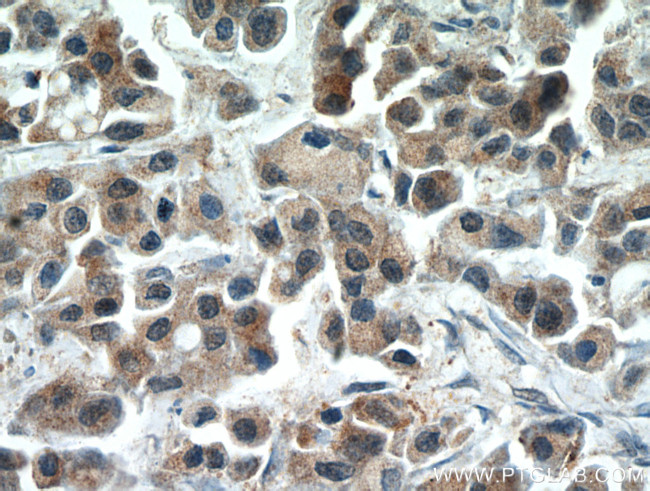 RERG Antibody in Immunohistochemistry (Paraffin) (IHC (P))