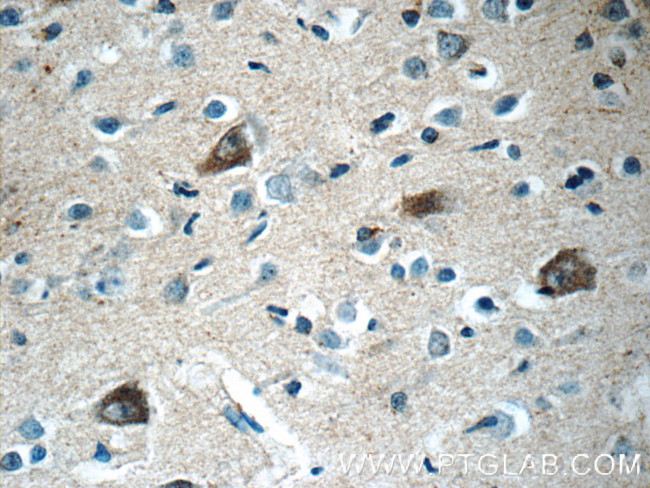 RERG Antibody in Immunohistochemistry (Paraffin) (IHC (P))