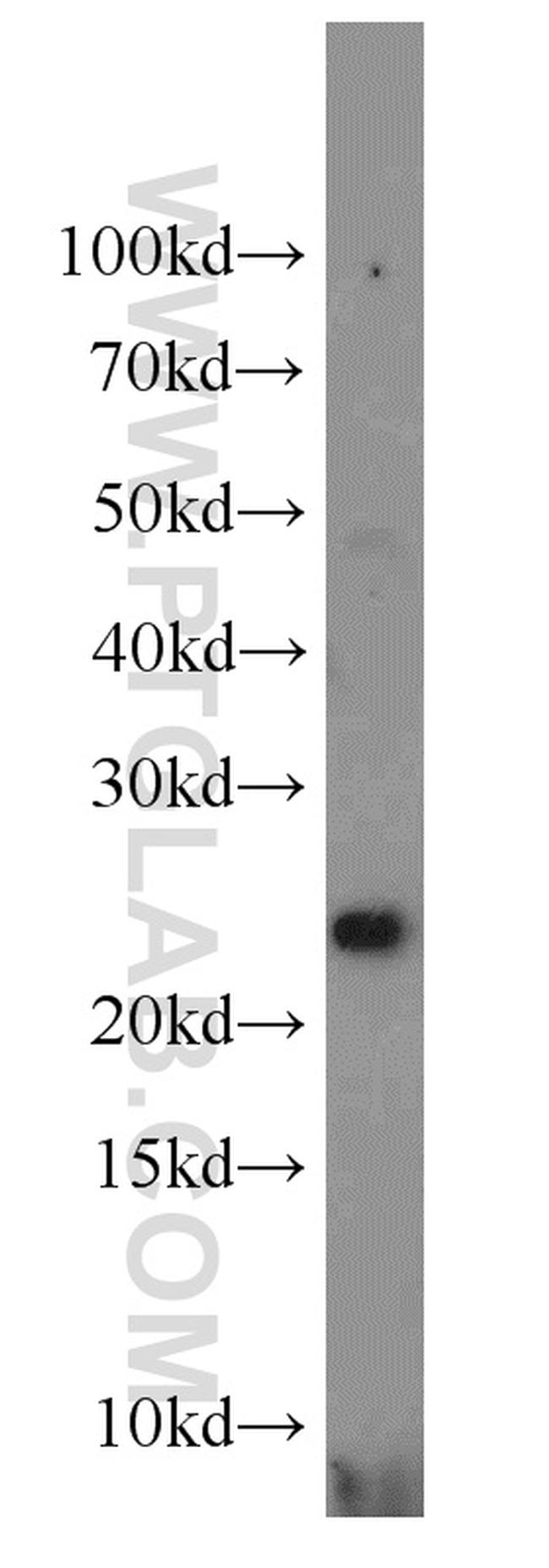 RERG Antibody in Western Blot (WB)