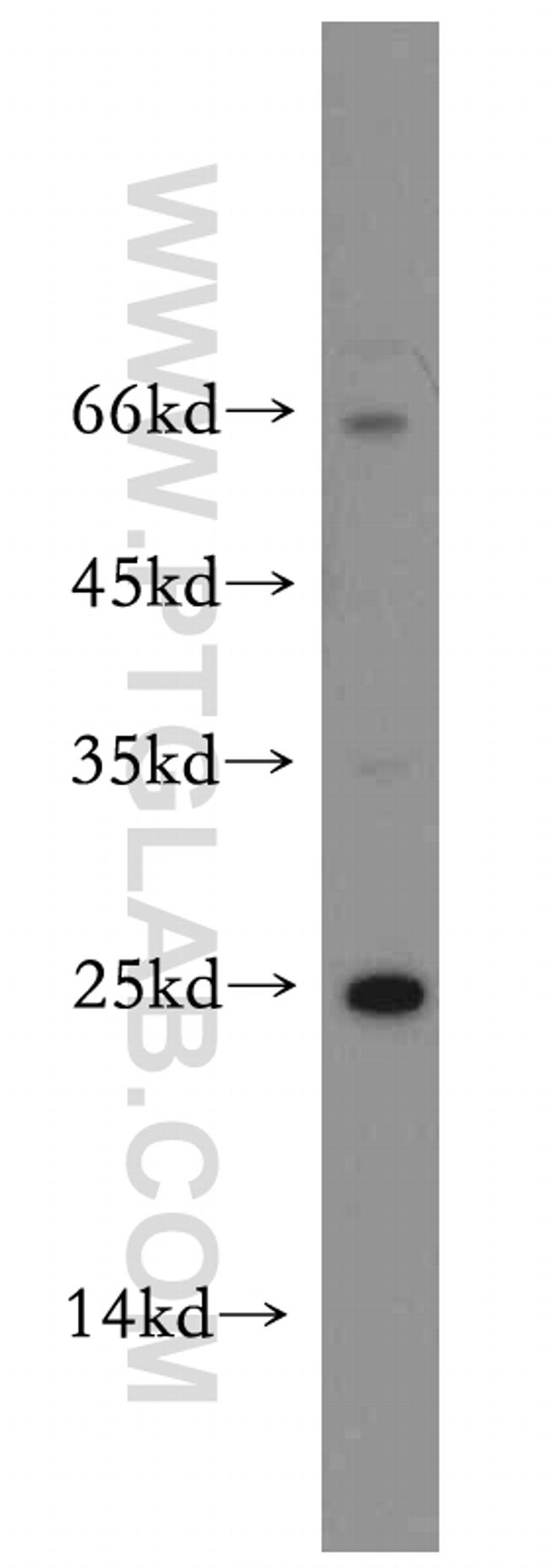 RERG Antibody in Western Blot (WB)