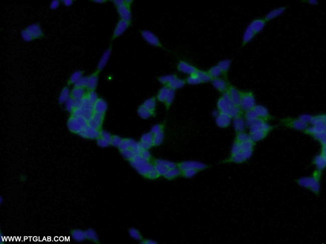 MMS2 Antibody in Immunocytochemistry (ICC/IF)