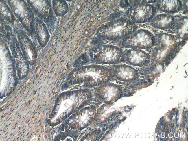 MMS2 Antibody in Immunohistochemistry (Paraffin) (IHC (P))