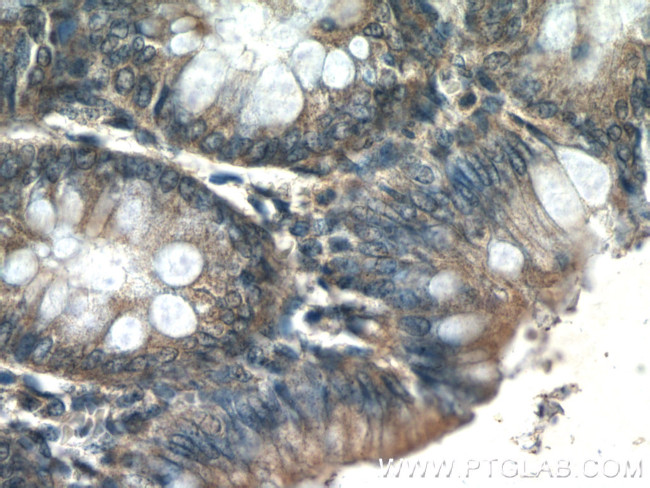 MMS2 Antibody in Immunohistochemistry (Paraffin) (IHC (P))