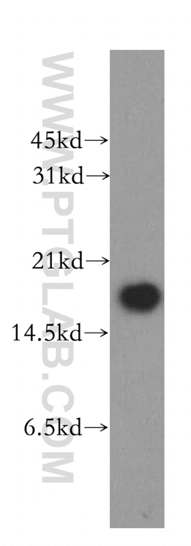 MMS2 Antibody in Western Blot (WB)