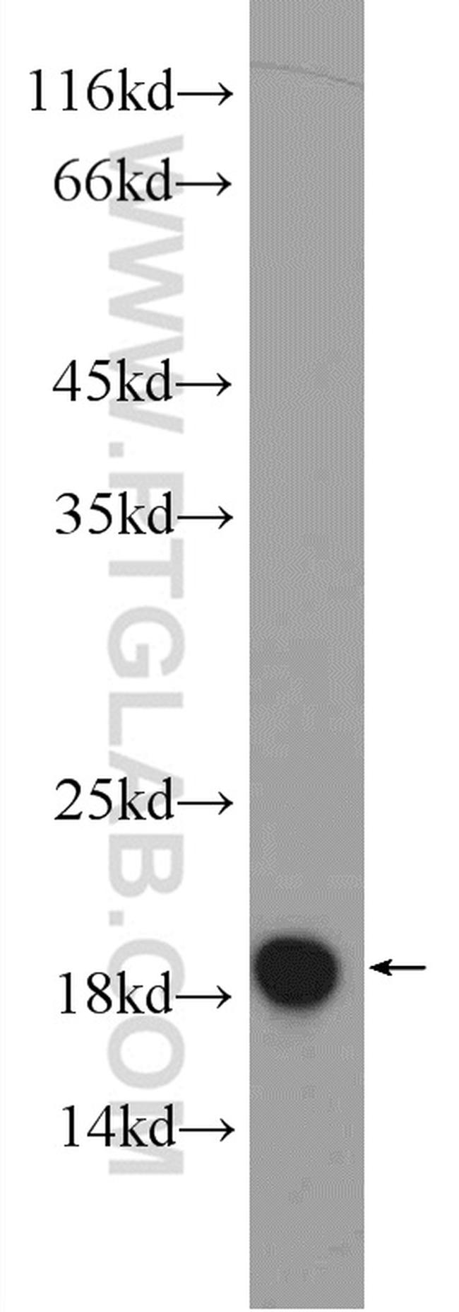 MMS2 Antibody in Western Blot (WB)