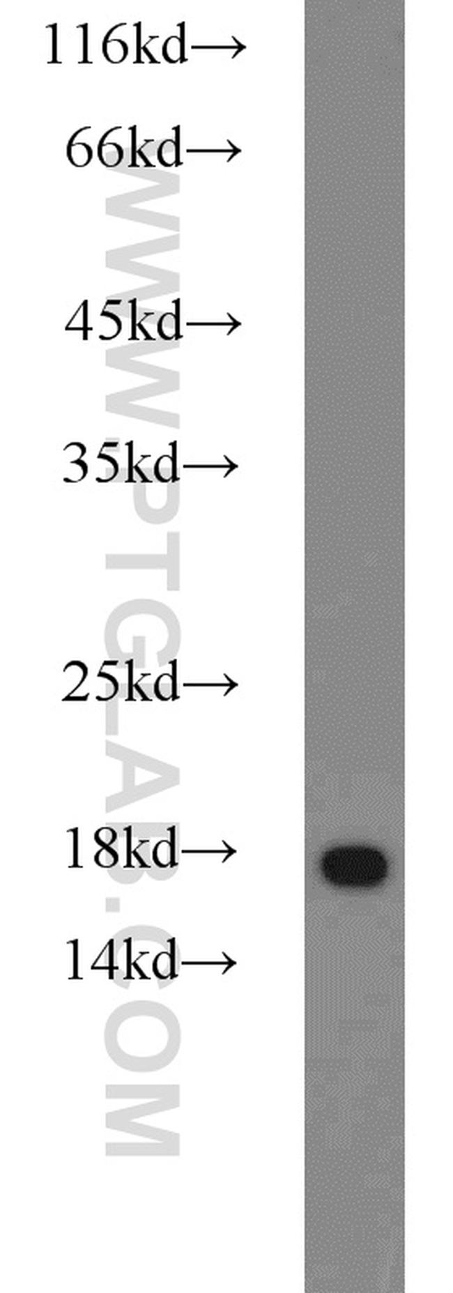 MMS2 Antibody in Western Blot (WB)