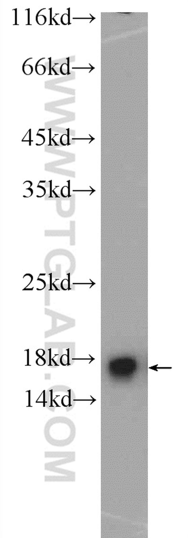 MMS2 Antibody in Western Blot (WB)