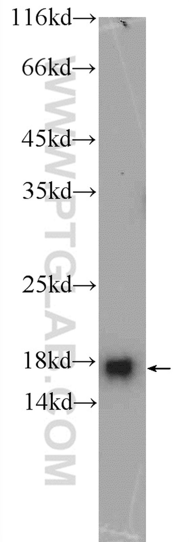 MMS2 Antibody in Western Blot (WB)