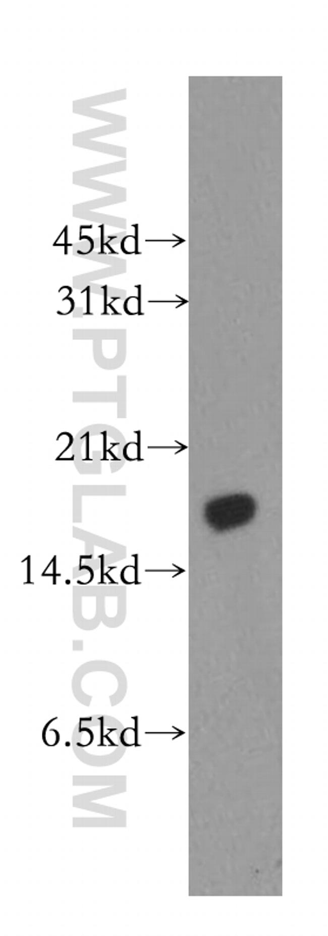 MMS2 Antibody in Western Blot (WB)