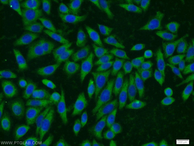 MMS2 Antibody in Immunocytochemistry (ICC/IF)