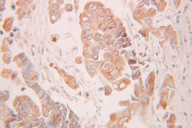 MMS2 Antibody in Immunohistochemistry (Paraffin) (IHC (P))