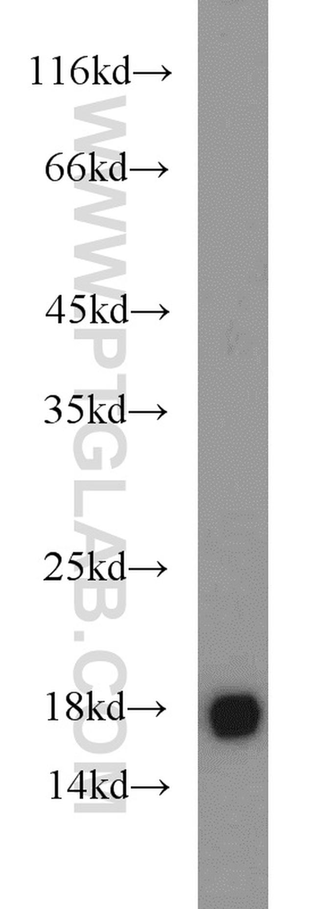 MMS2 Antibody in Western Blot (WB)