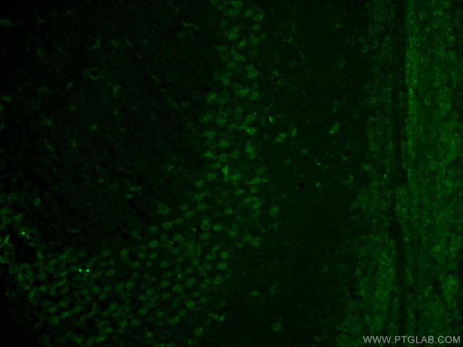 GMF-beta Antibody in Immunohistochemistry (PFA fixed) (IHC (PFA))