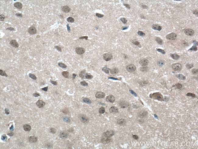 GMF-beta Antibody in Immunohistochemistry (Paraffin) (IHC (P))