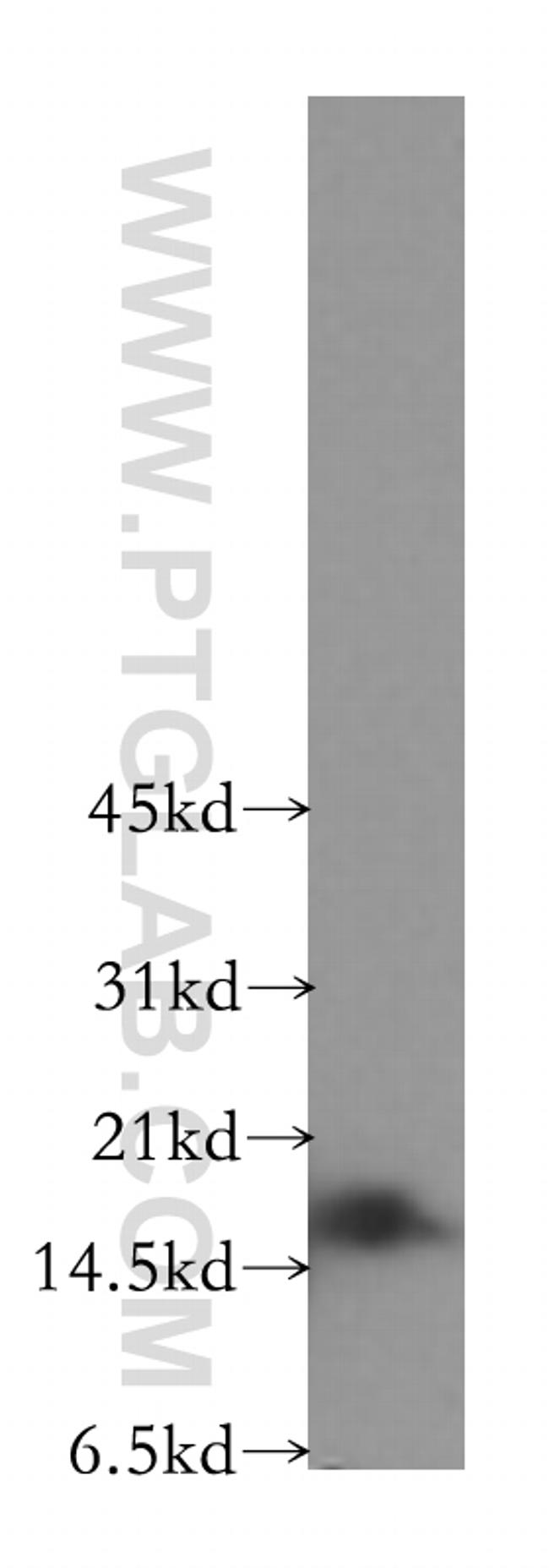 GMF-beta Antibody in Western Blot (WB)