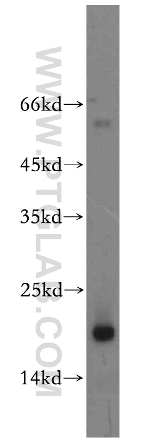 GMF-beta Antibody in Western Blot (WB)