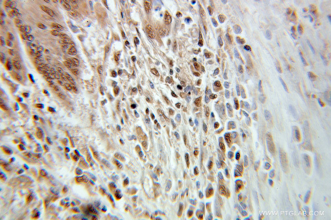 GMF-beta Antibody in Immunohistochemistry (Paraffin) (IHC (P))