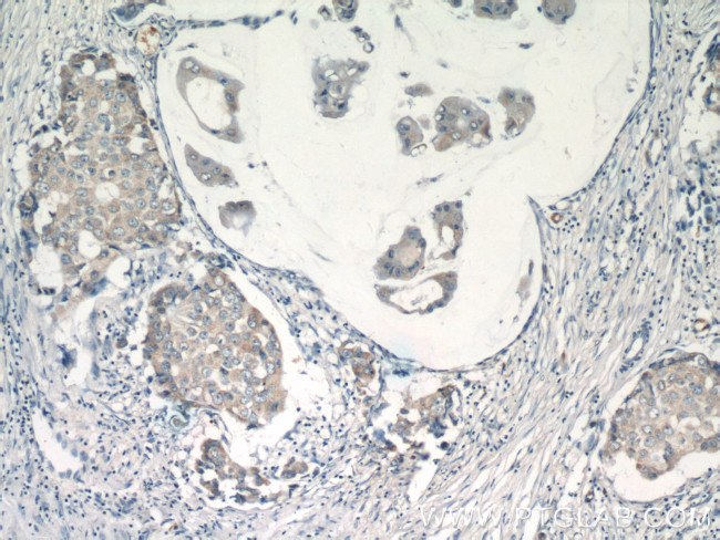 CUL4A Antibody in Immunohistochemistry (Paraffin) (IHC (P))