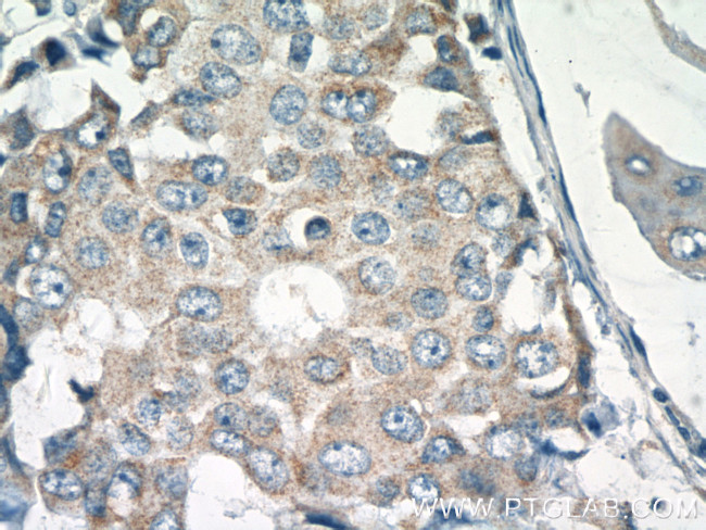 CUL4A Antibody in Immunohistochemistry (Paraffin) (IHC (P))