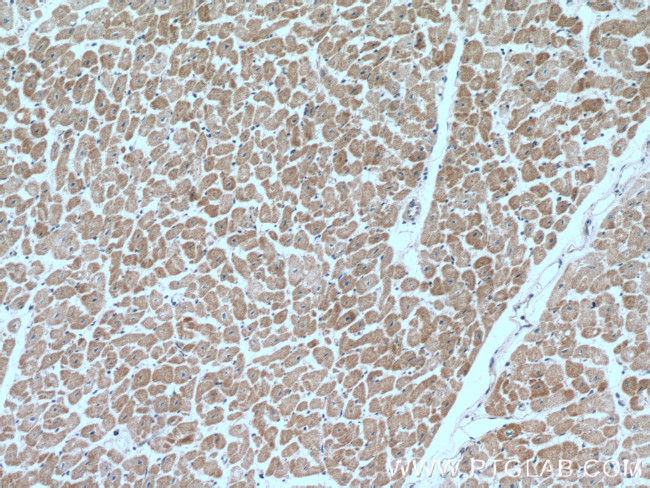 CUL4A Antibody in Immunohistochemistry (Paraffin) (IHC (P))