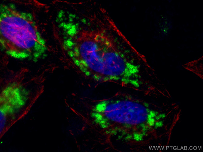 TIP47 Antibody in Immunocytochemistry (ICC/IF)