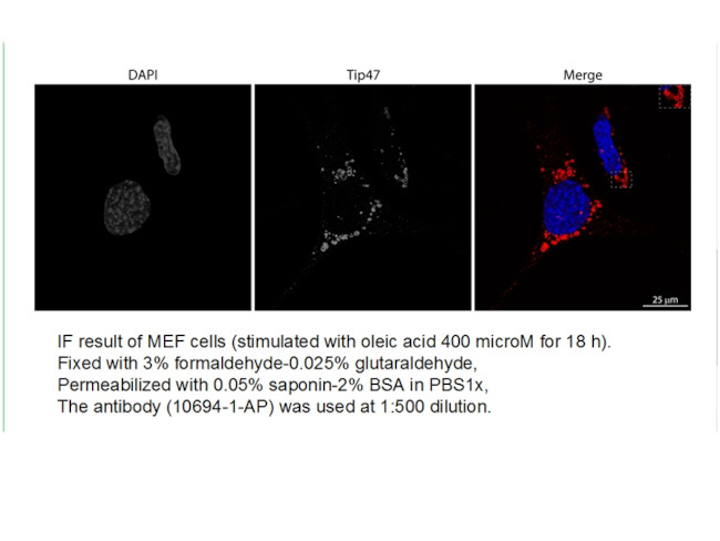TIP47 Antibody in Immunocytochemistry (ICC/IF)