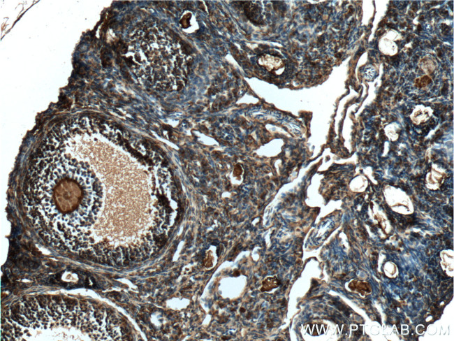 TIP47 Antibody in Immunohistochemistry (Paraffin) (IHC (P))