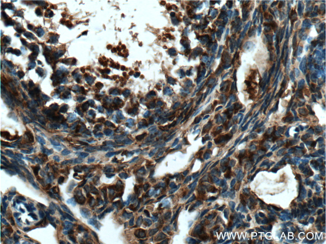 TIP47 Antibody in Immunohistochemistry (Paraffin) (IHC (P))