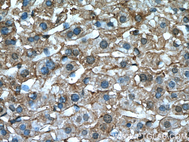 TIP47 Antibody in Immunohistochemistry (Paraffin) (IHC (P))