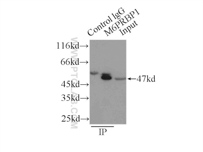 TIP47 Antibody in Immunoprecipitation (IP)