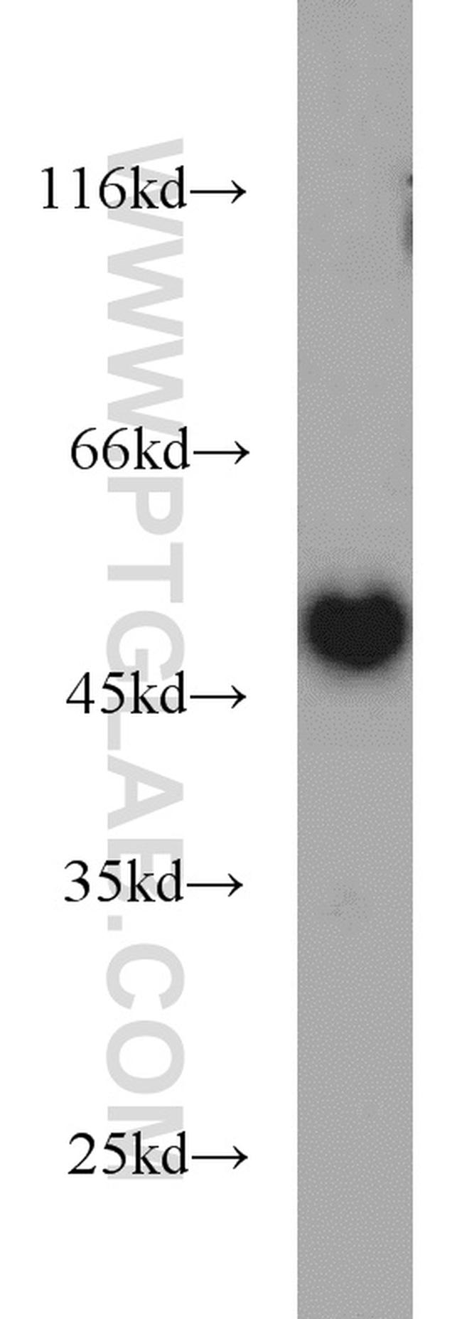 TIP47 Antibody in Western Blot (WB)