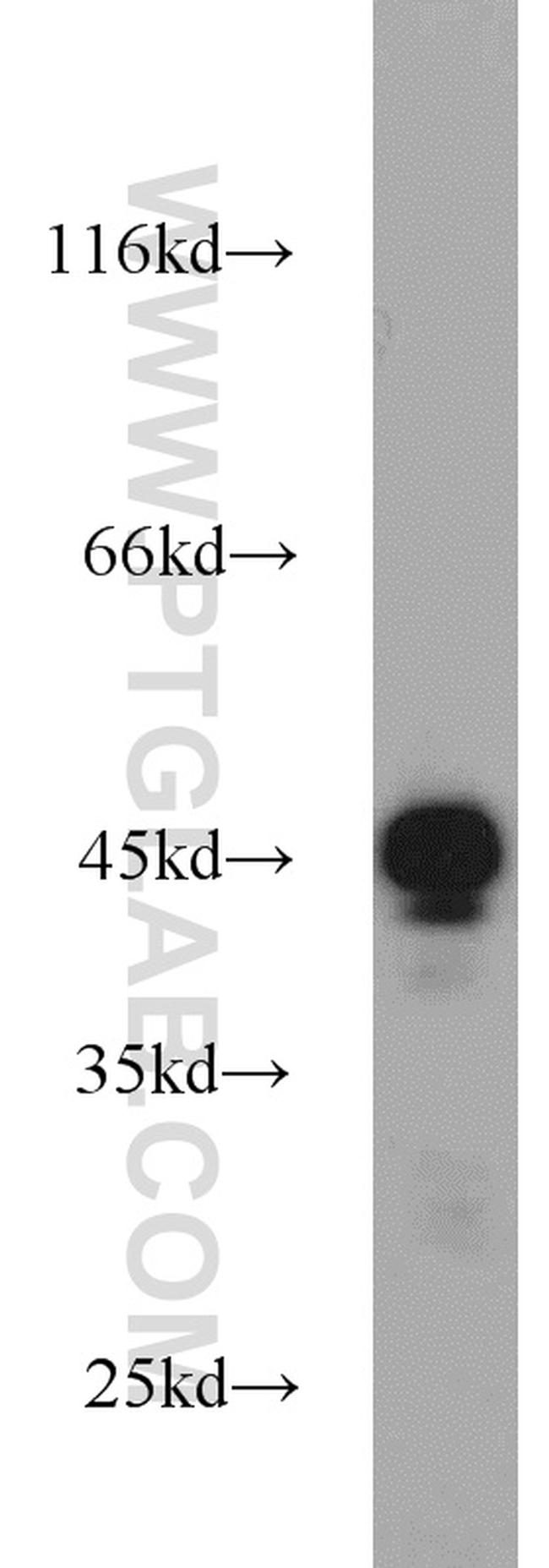 TIP47 Antibody in Western Blot (WB)