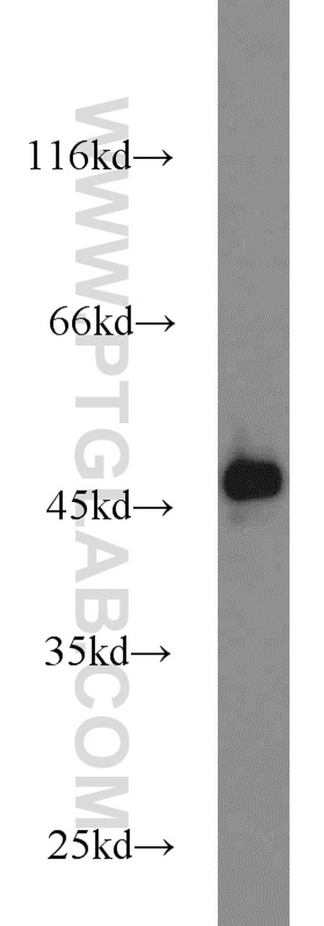 TIP47 Antibody in Western Blot (WB)