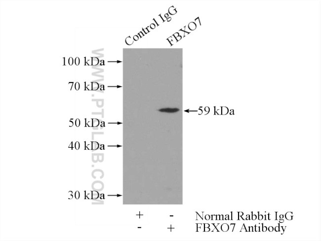 FBXO7 Antibody in Immunoprecipitation (IP)