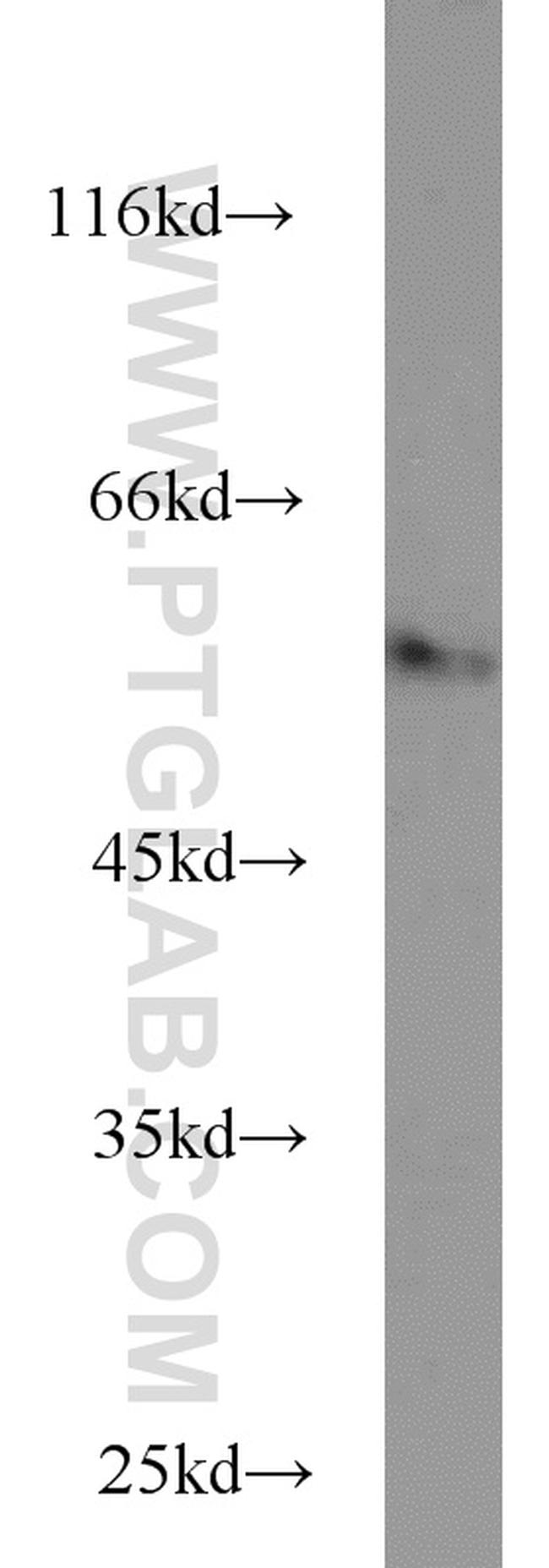 FBXO7 Antibody in Western Blot (WB)