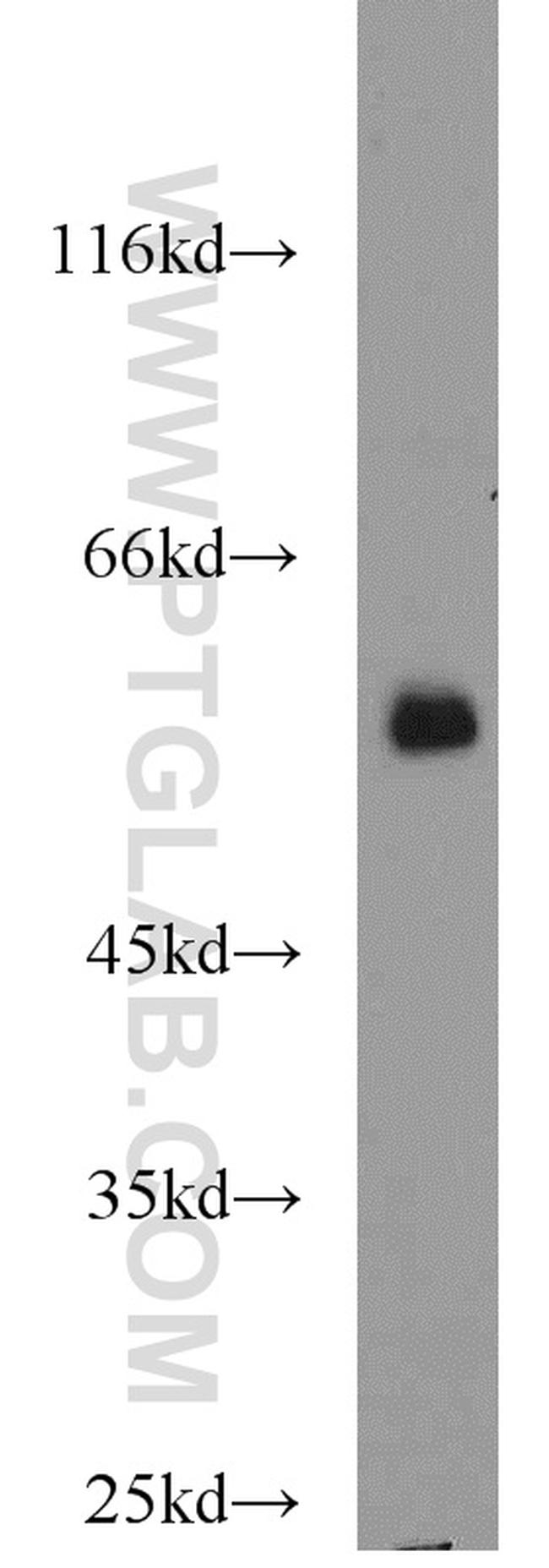 FBXO7 Antibody in Western Blot (WB)