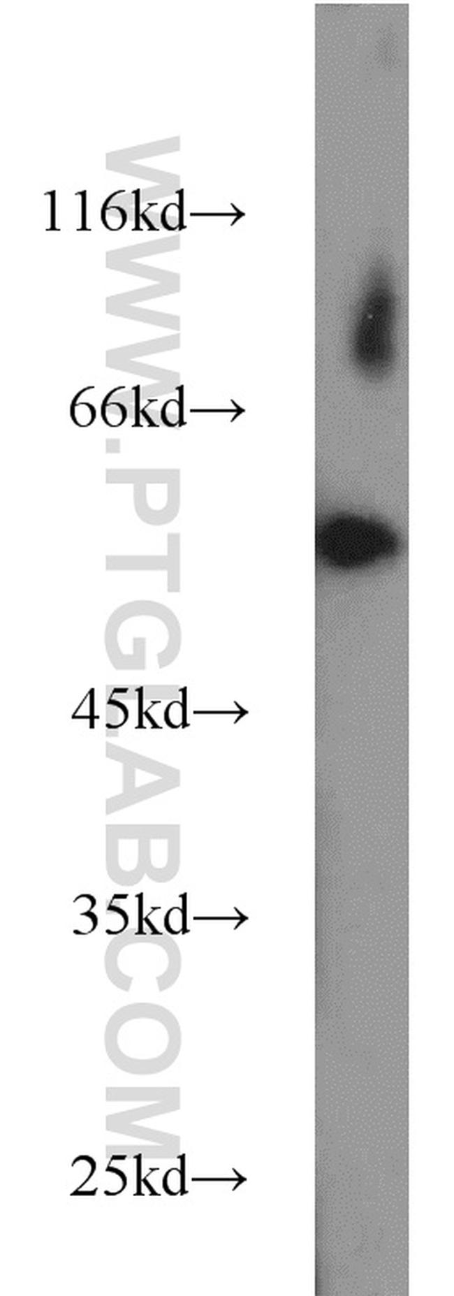 FBXO7 Antibody in Western Blot (WB)