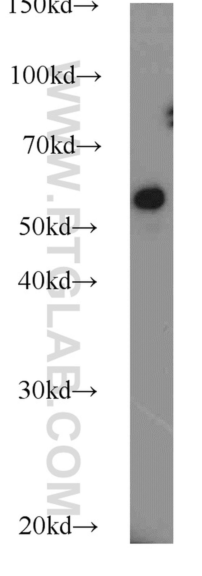 FBXO7 Antibody in Western Blot (WB)