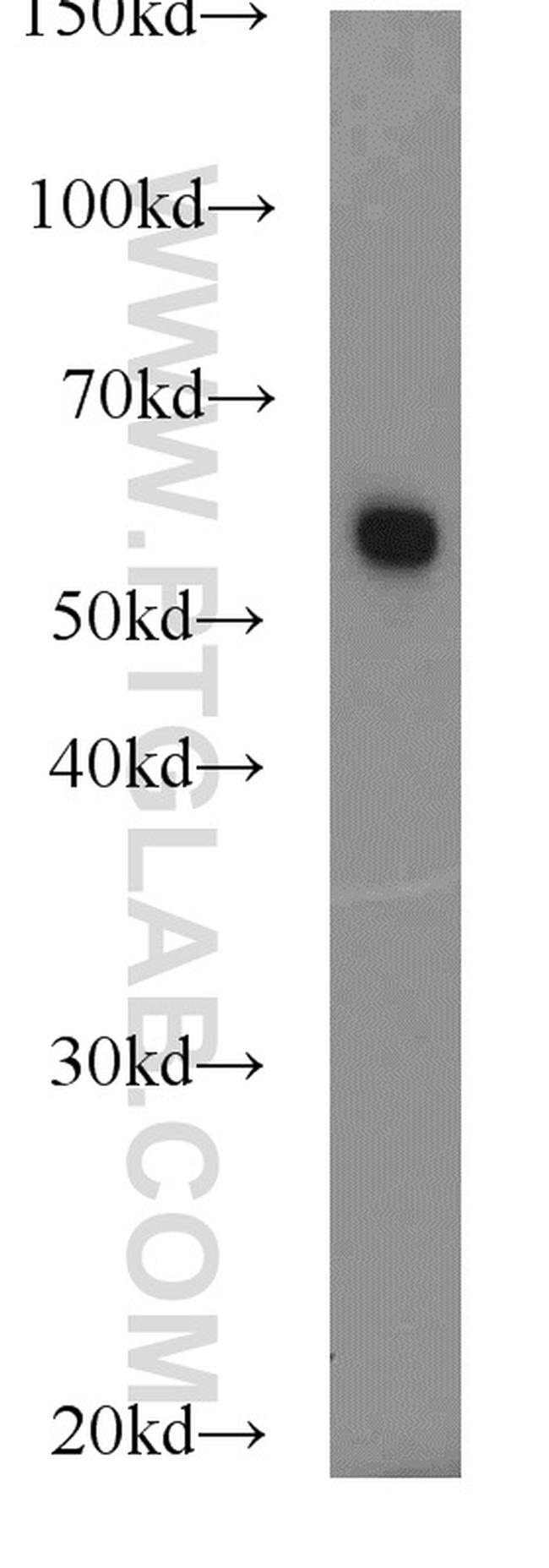 FBXO7 Antibody in Western Blot (WB)